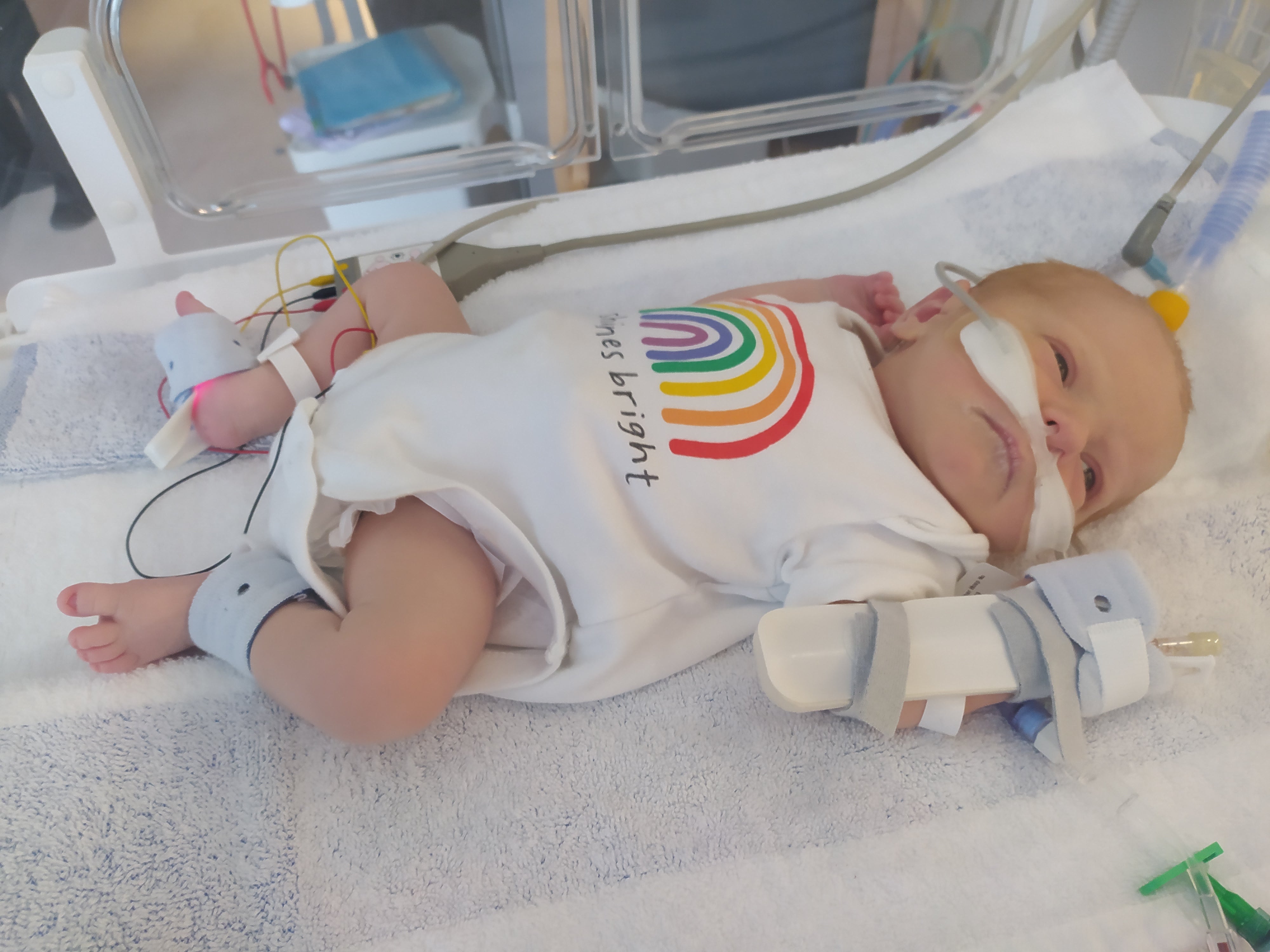 Doctors initially thought Leon had fluid in his lungs and then an unknown infection, and he spent seven days in the neonatal intensive care unit.